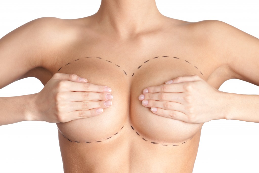 mamoplastia aumento