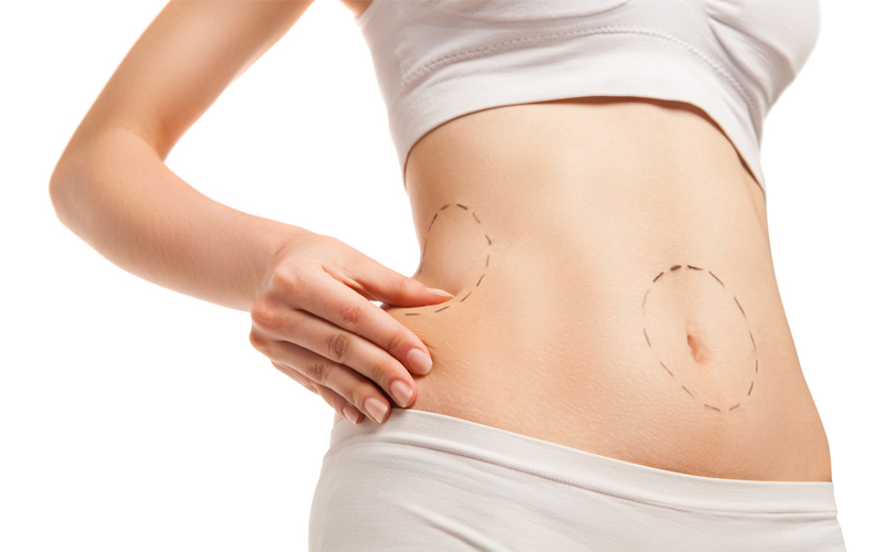 valor de la abdominoplastia