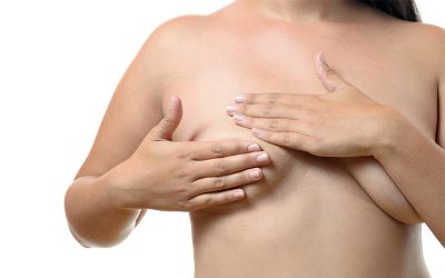 cirugía mamaria